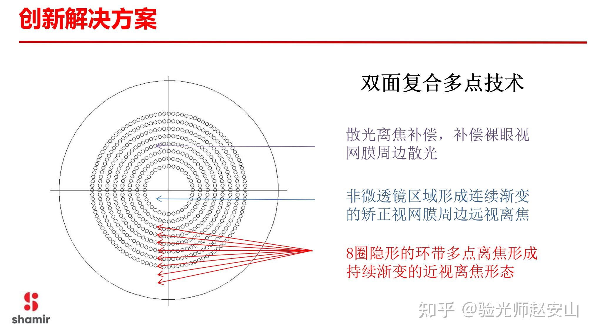 近視控制型離焦鏡片管用嗎它控制近視度數的原理是什麼