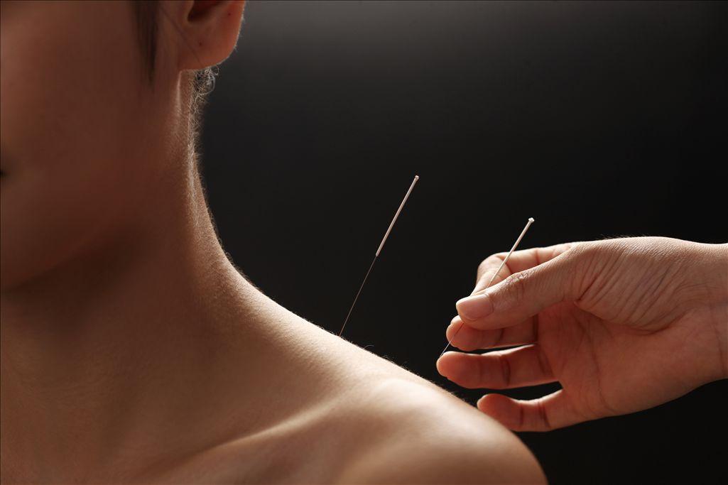 美国针灸师执照能否转成中国中医师执照? - 知乎