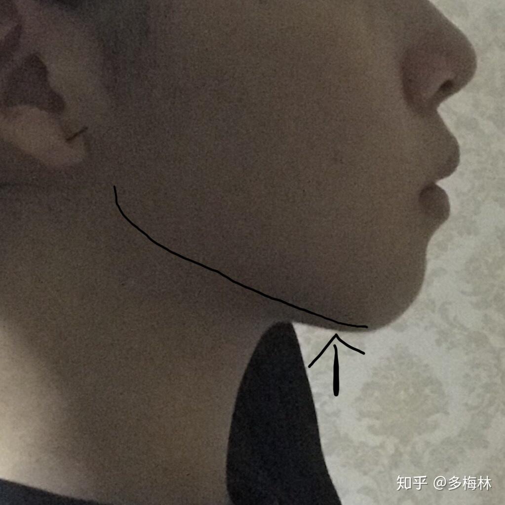 长得好看但没下巴是什么体验?