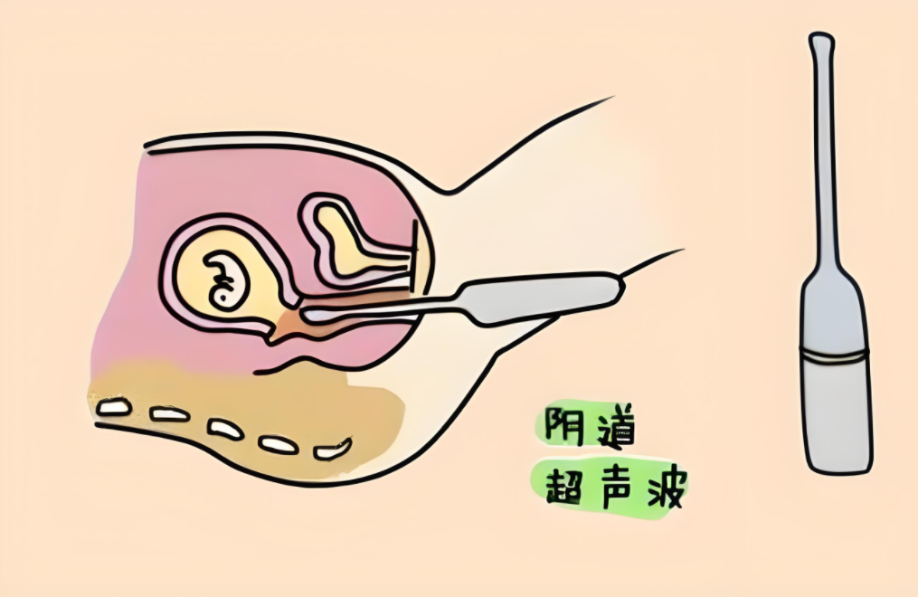 孕早期做阴超对胎儿有哪些影响?