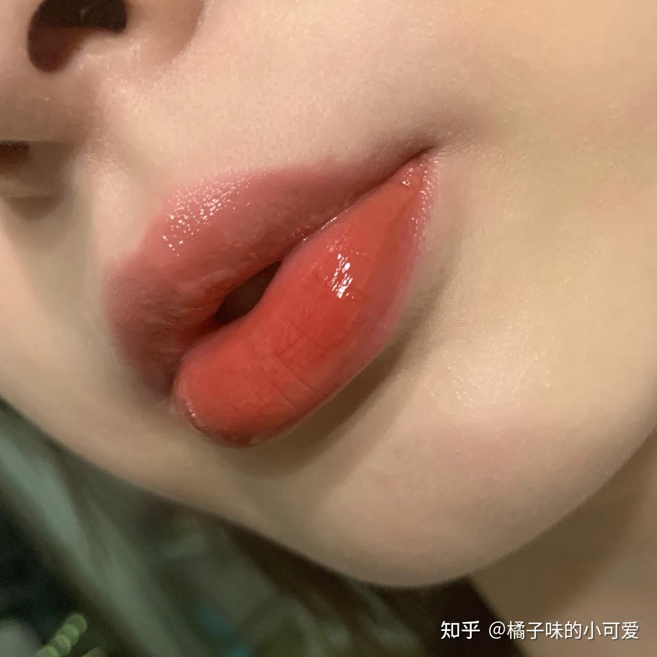 女生长唇毛除冰点脱毛外有什么方法可去除唇毛