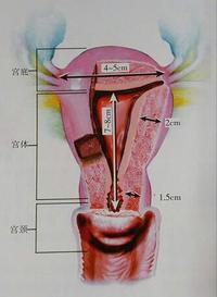 宫颈粘连 - 知乎