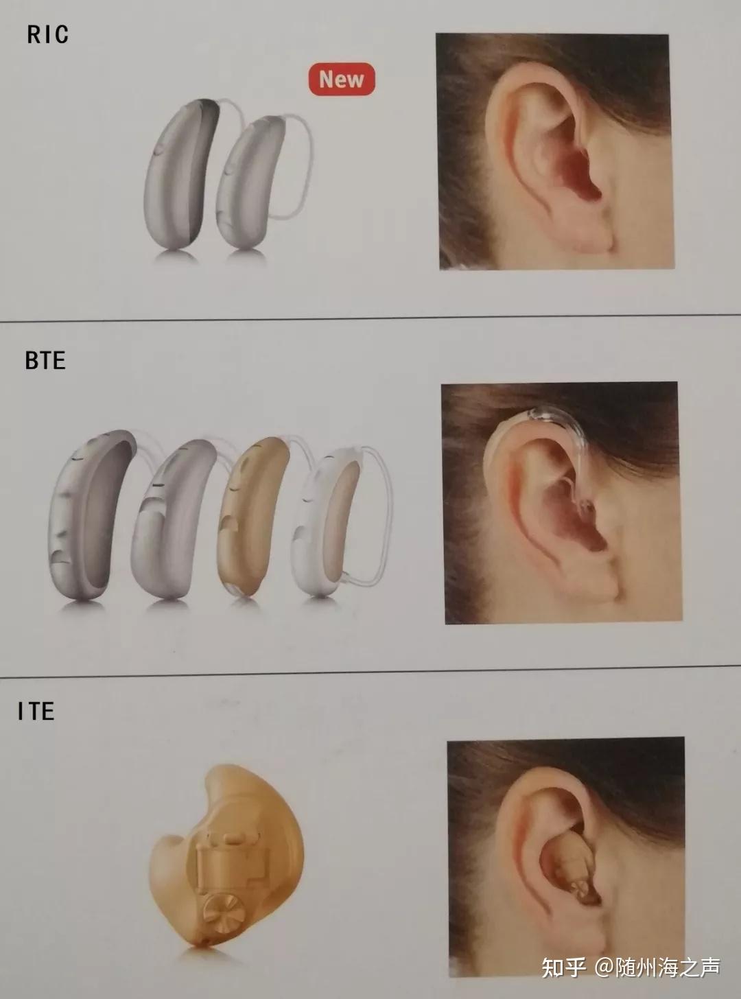 ric助聽器具體有哪些優點呢