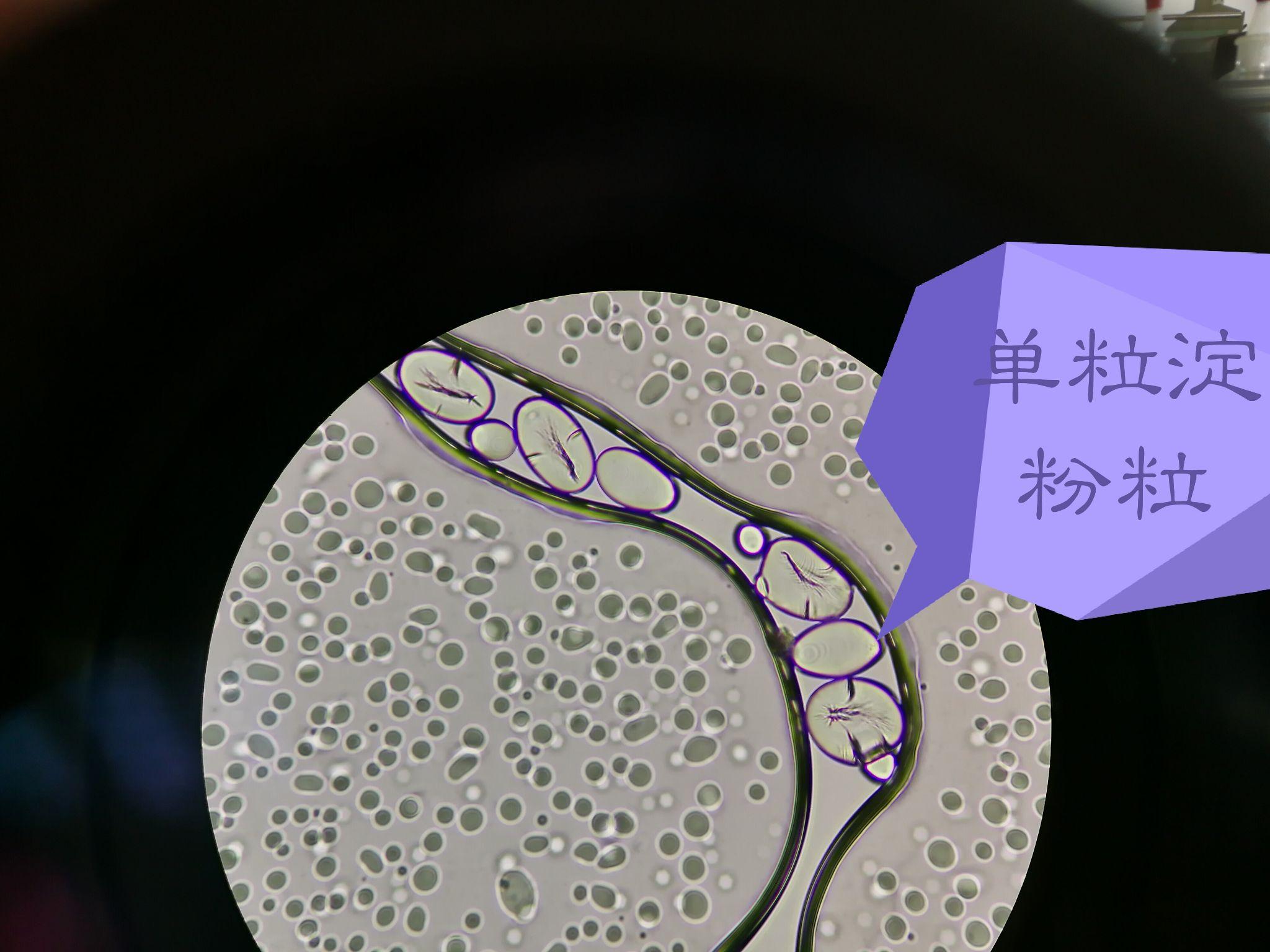 关于单粒淀粉粒,复粒淀粉粒,半复粒淀粉粒的结构? - 知乎