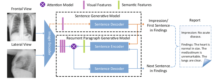 [论文笔记]Multimodal Recurrent Model with Attention for Automated Radiology ...