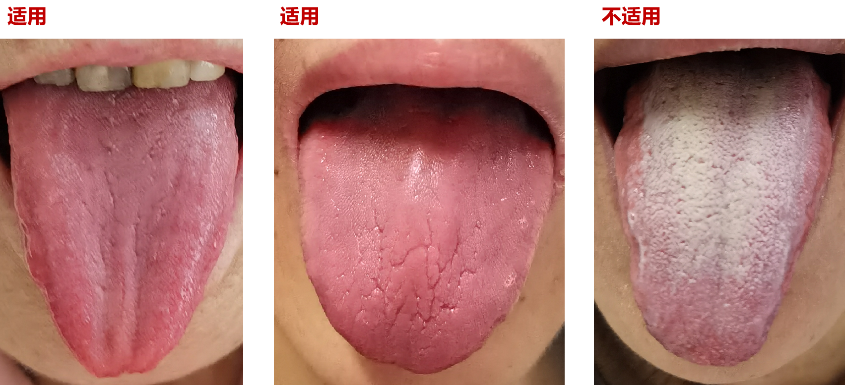 每天喝2升水还是嘴巴发干,该怎么办? - 知乎