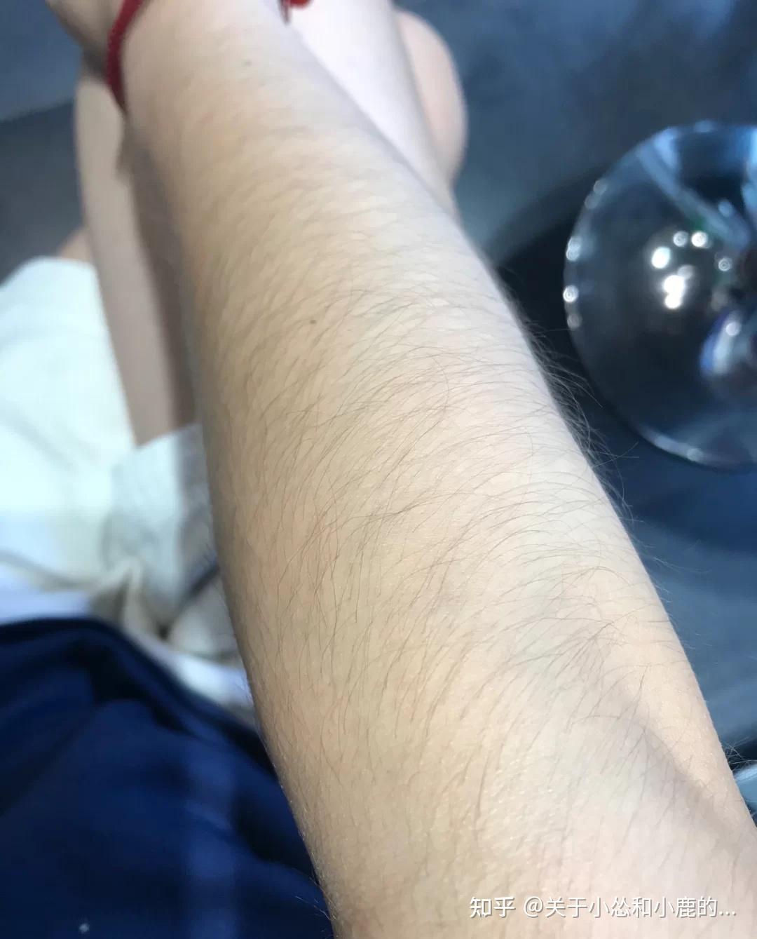 女生汗毛重是怎样的一种体验? - 知乎