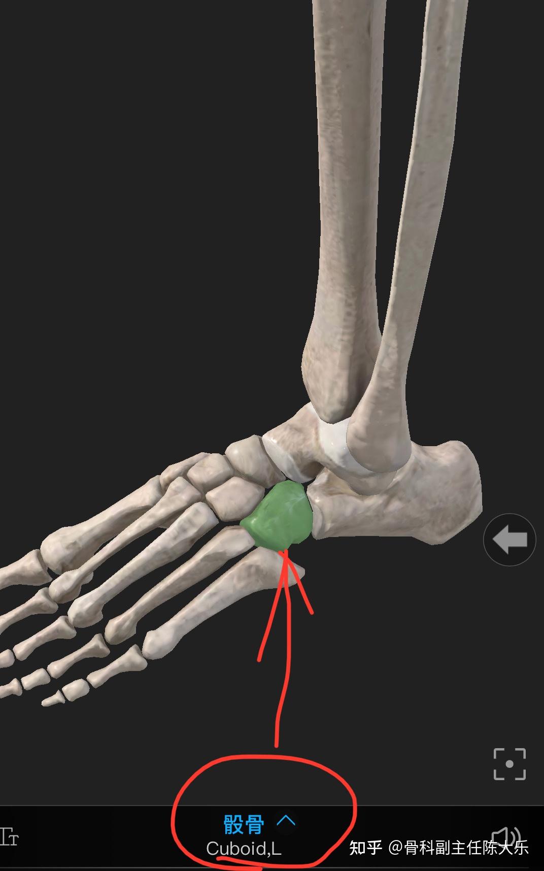 脚骰骨突出图片图片