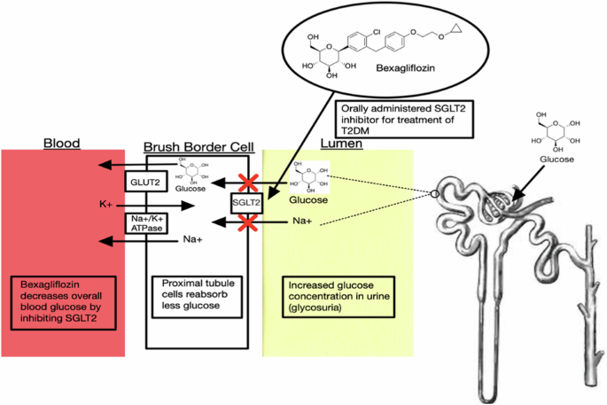FDA已批准SGLT2 抑制剂的全面总结 - 知乎