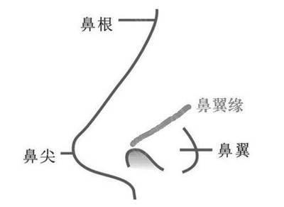 案例分享︱狮子鼻如何改善?