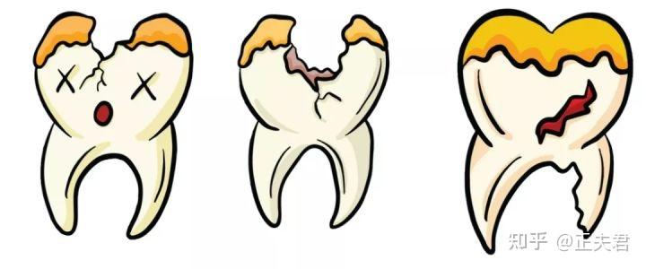 蛀牙不补可以吗
