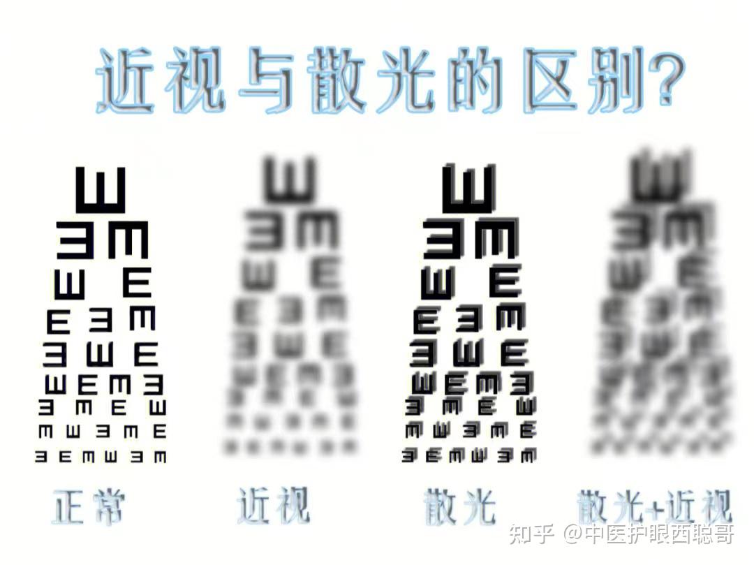 近视和散光哪个严重?近视散光可以恢复吗? - 知乎