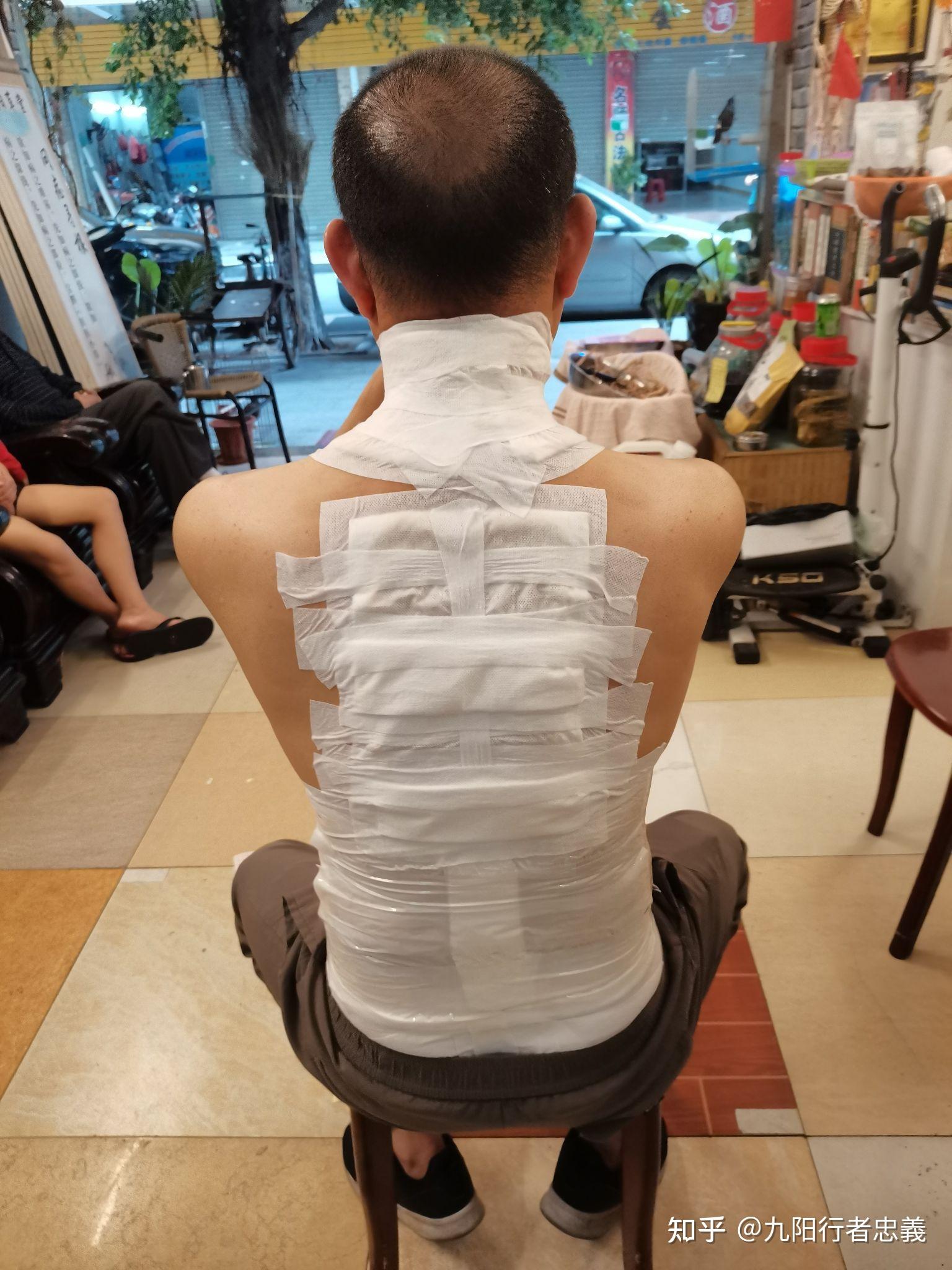 腰椎间盘突出用什么外敷贴好