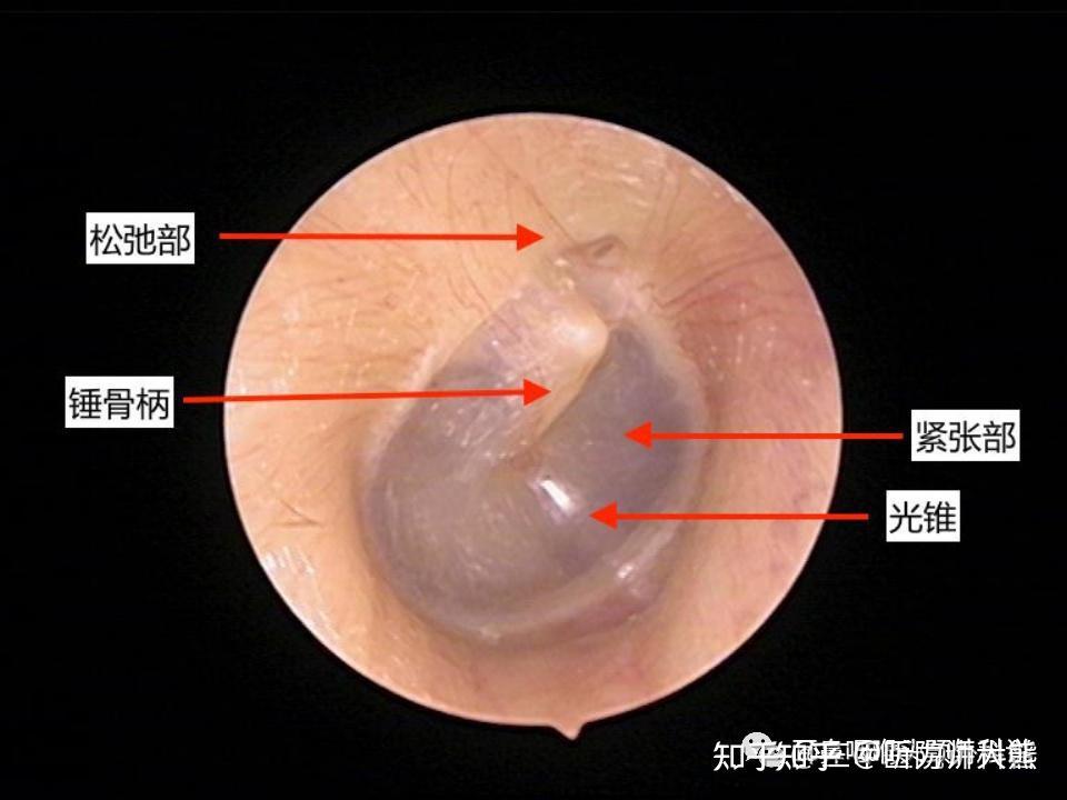 小孩的耳膜有多深图片图片