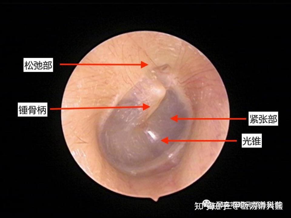 问一下这个是不是耳膜?