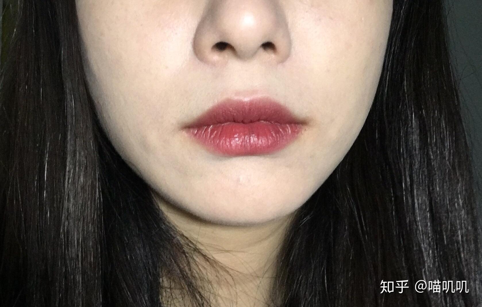 为什么嘴巴两边嘴角会有凸出来的肉肉看整体面相的话比看这个局部更