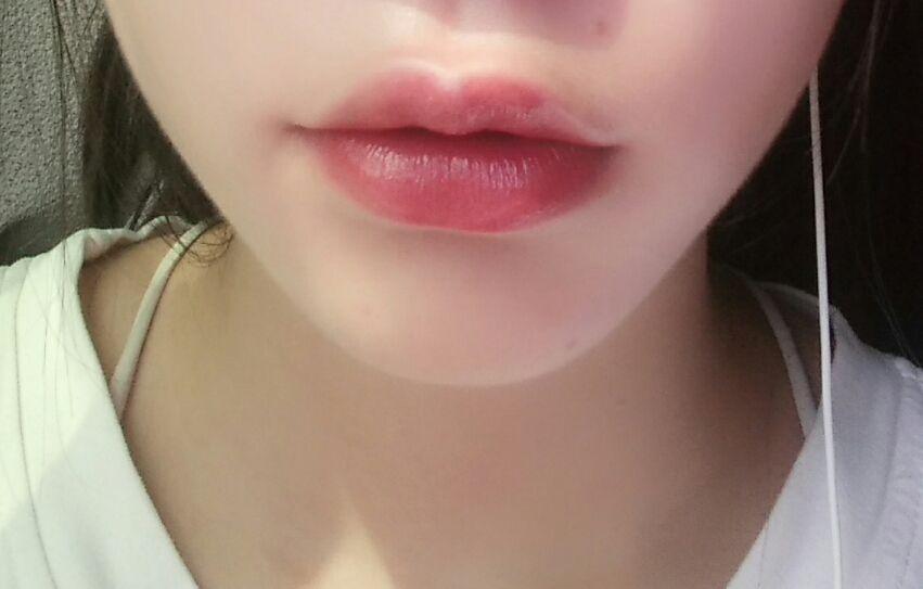 上嘴唇上翘,上翻怎么办?侧面看起来简直丑哭我! - 知乎