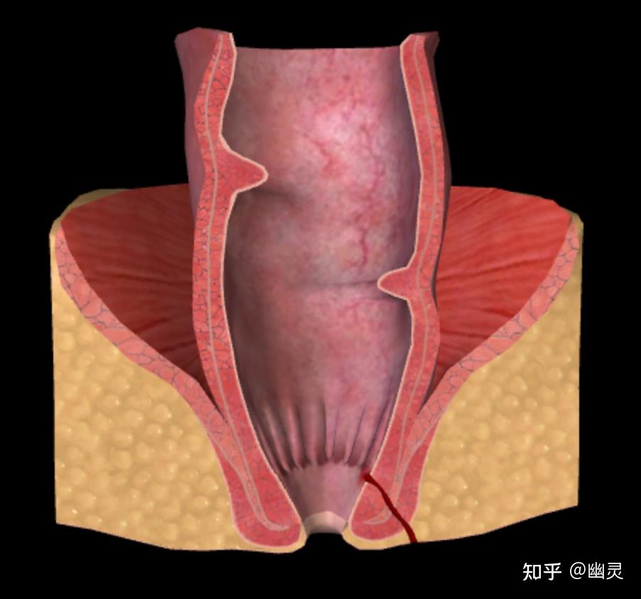 肛门直肠瘘常见的症状有哪些? - 知乎