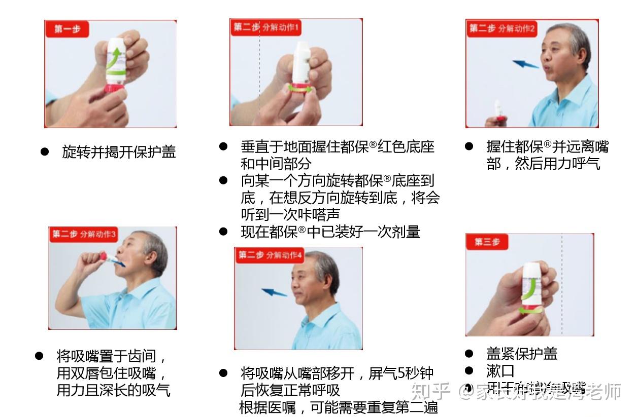 信必可都保装置的原理? - 知乎