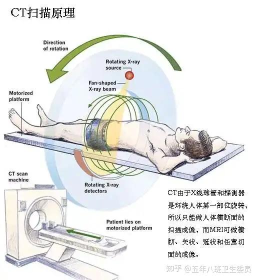【科普】CT扫描:医学界“透视眼” - 知乎
