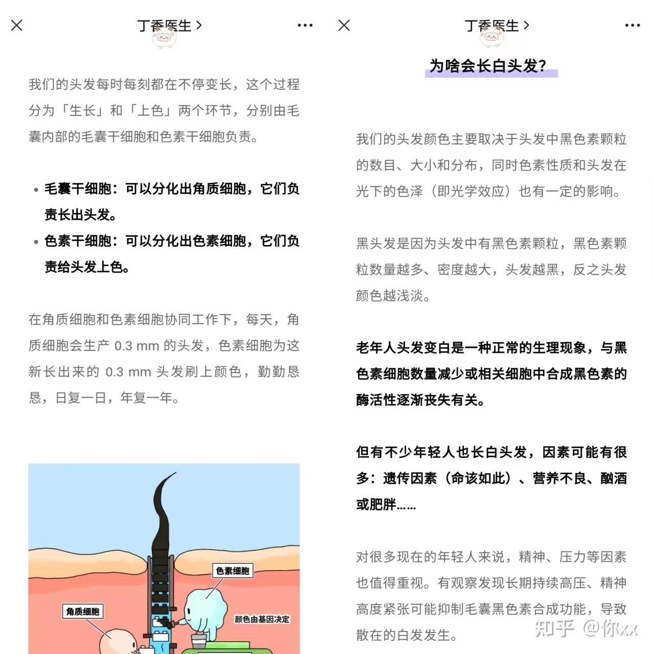 少年白(青少年长白发)怎么办?