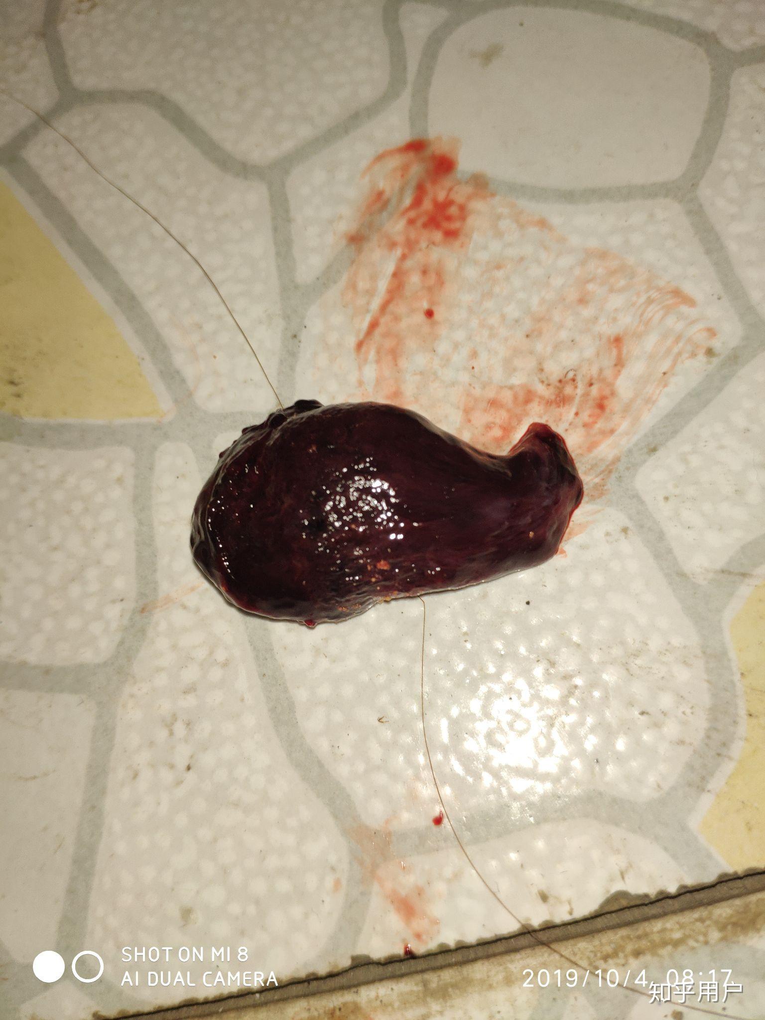 月经里有血块跟肉似的图片