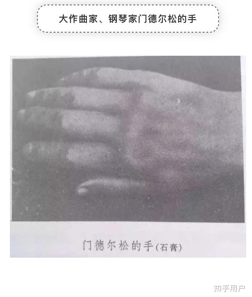 这样的手适合弹钢琴吗? - 知乎