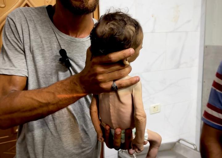 当加沙饥饿儿童的身体达到"不可逆转"的程度时