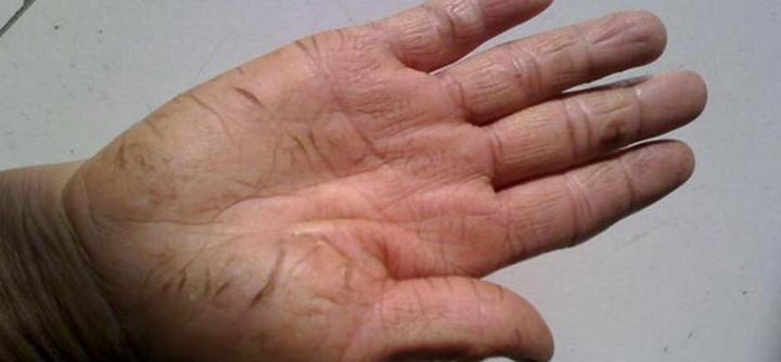 冬天手开裂怎么办皲裂修复护手霜推荐什么牌子的好