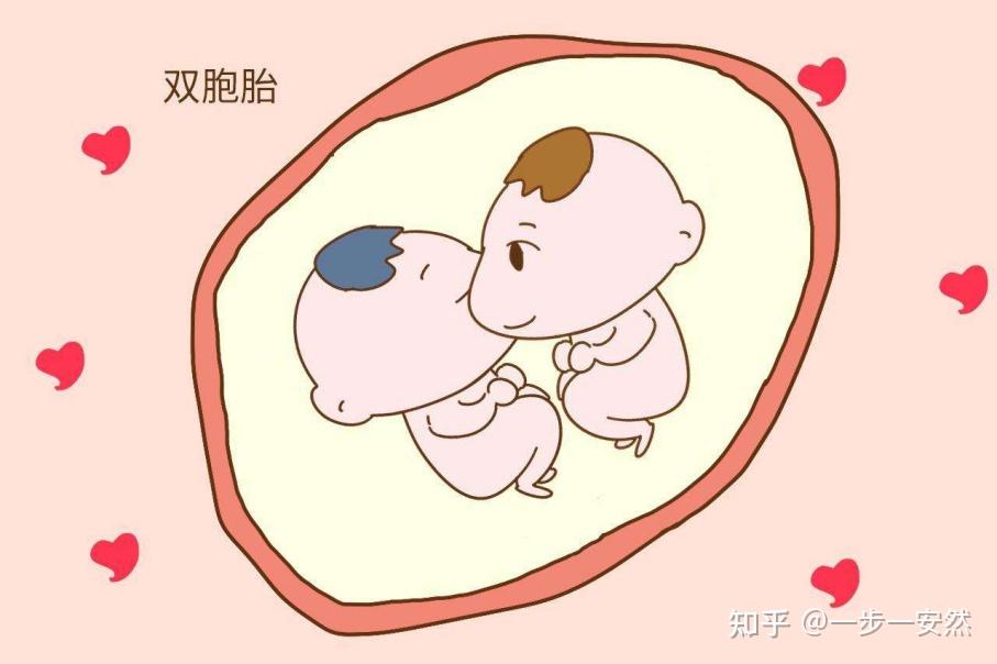 多胎妊娠是怎么一回事? - 知乎