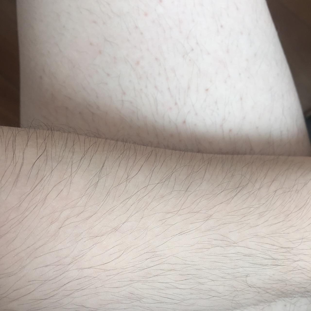 女生腿毛旺盛是怎样的人生体验