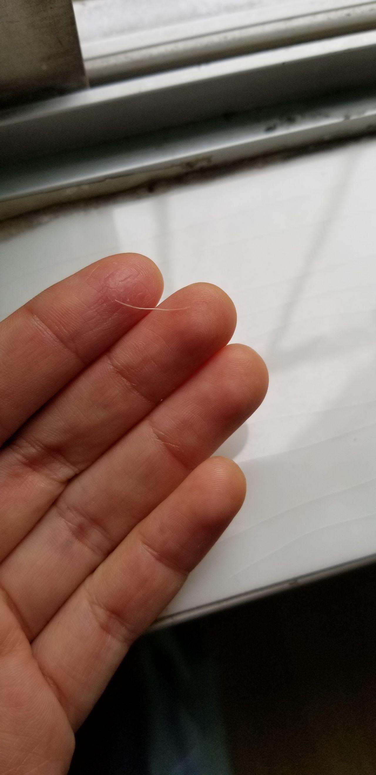 去医院取鱼刺是种什么样的体验