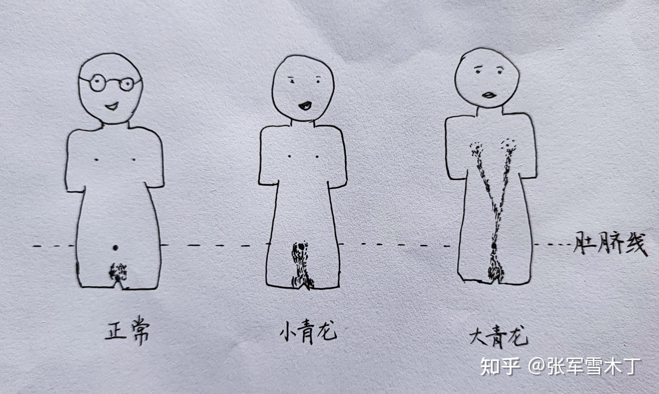 请问谁知道男生胸部到肚子都是毛,那样是为什么.是不是青龙呢.