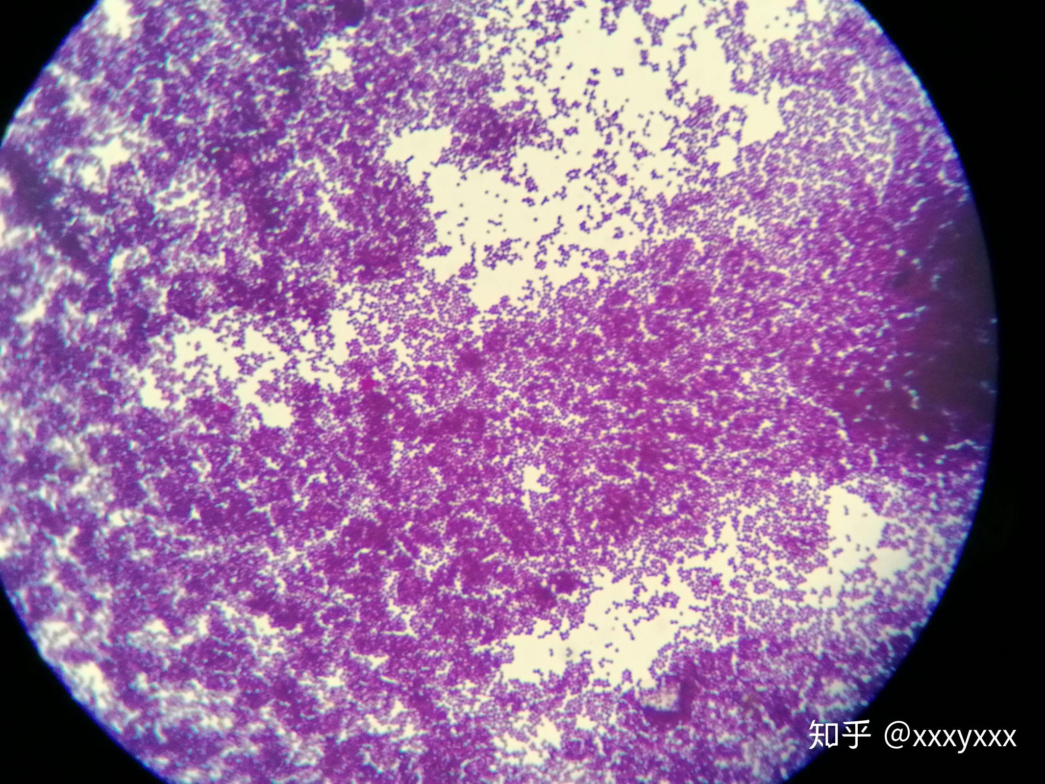 金黄色葡萄球菌在半固体培养基中的生长现象是什么样? - 知乎