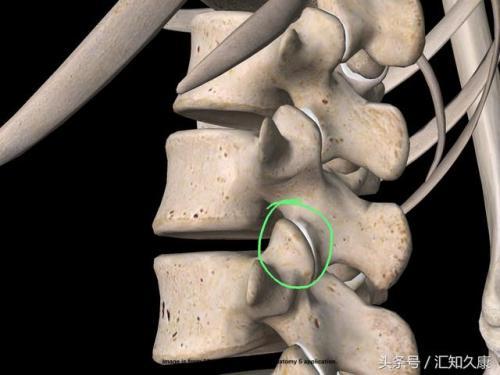颈椎横突前后结节图片图片
