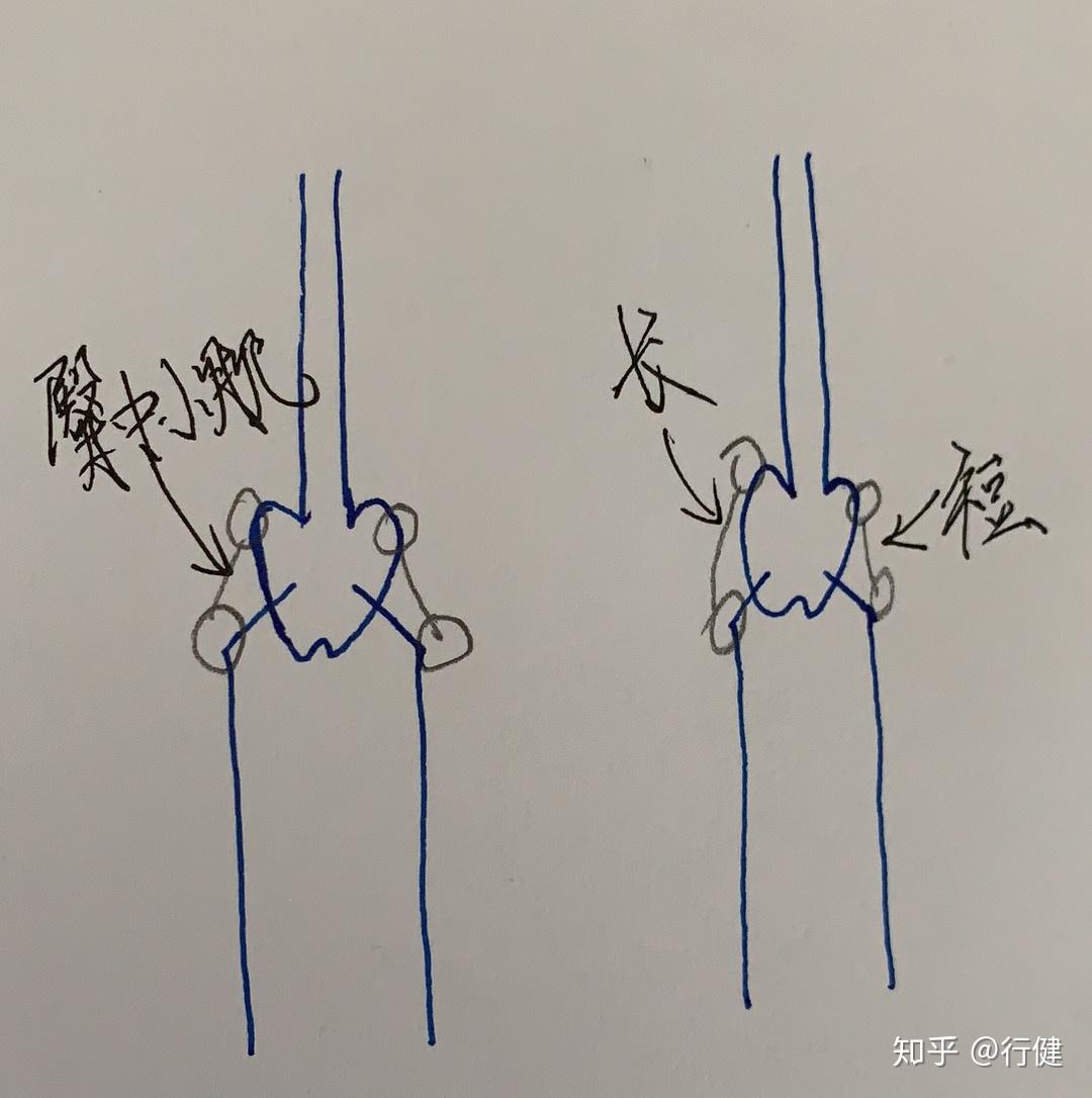 臀中肌臀小肌对于腰腿痛有什么意义