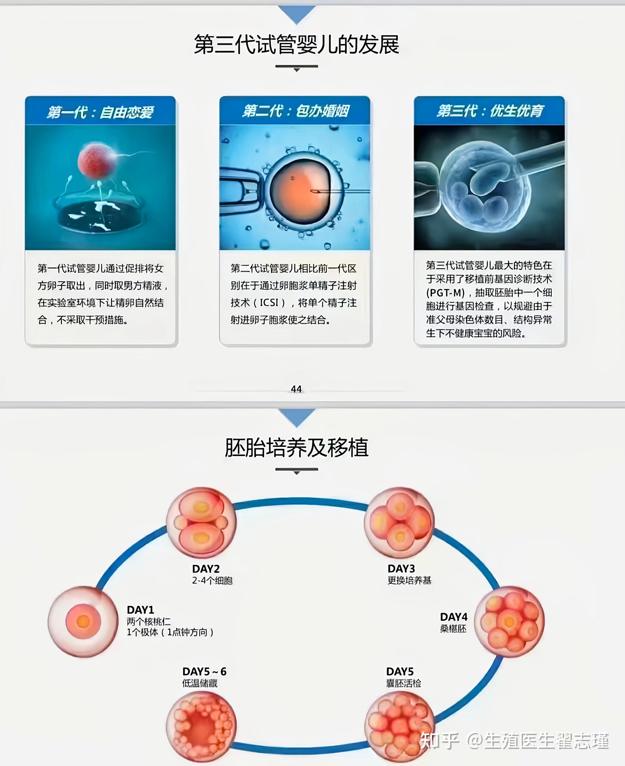 三代试管过程图片