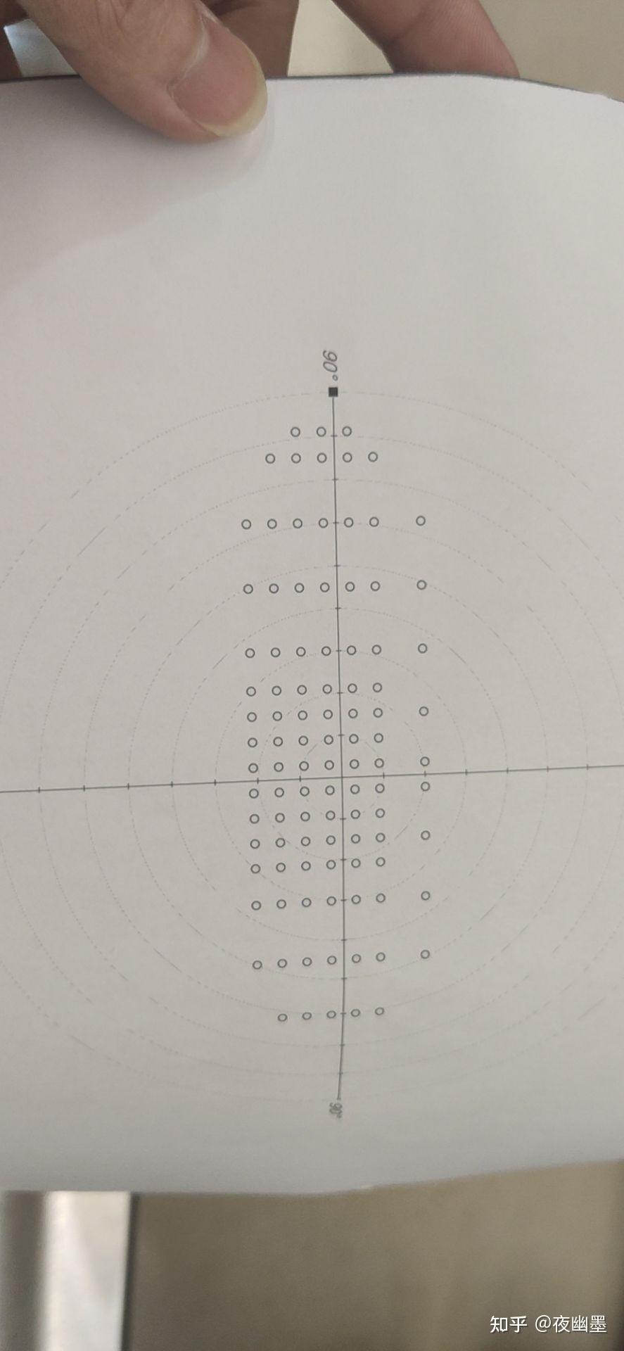 单眼水平视野检测的一百个点看到多少个才合格? - 知乎