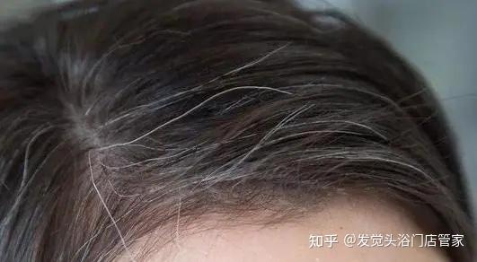 【发觉养发】养发产品如何选择? - 知乎