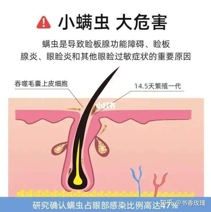 除螨仪有用吗?家用除螨仪有必要买吗?十大公认最好的除螨仪,小白精选款!