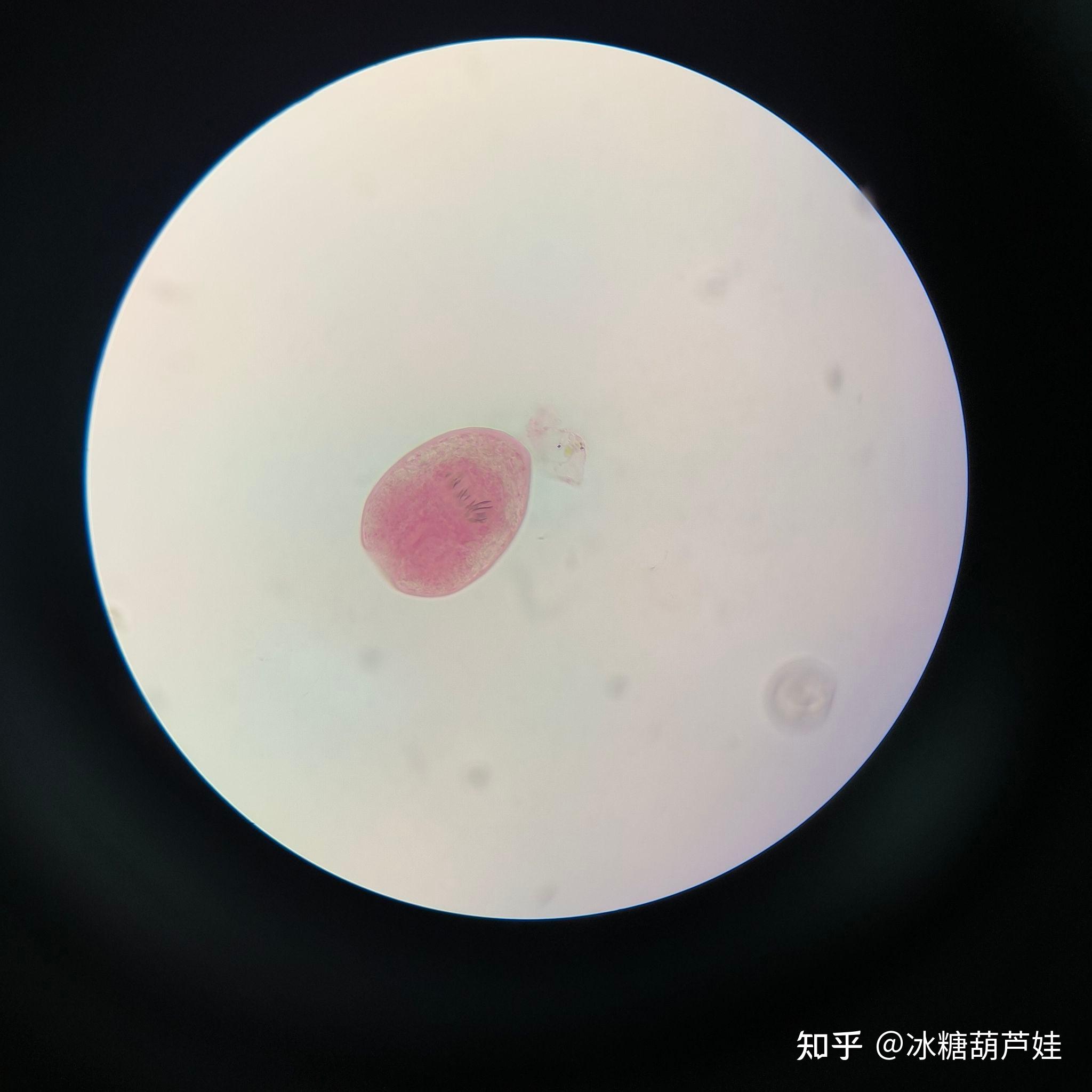 棘球蚴砂 3.曼氏迭宫绦虫裂头蚴 4.牛囊尾蚴 5.曼氏迭宫绦虫 6.