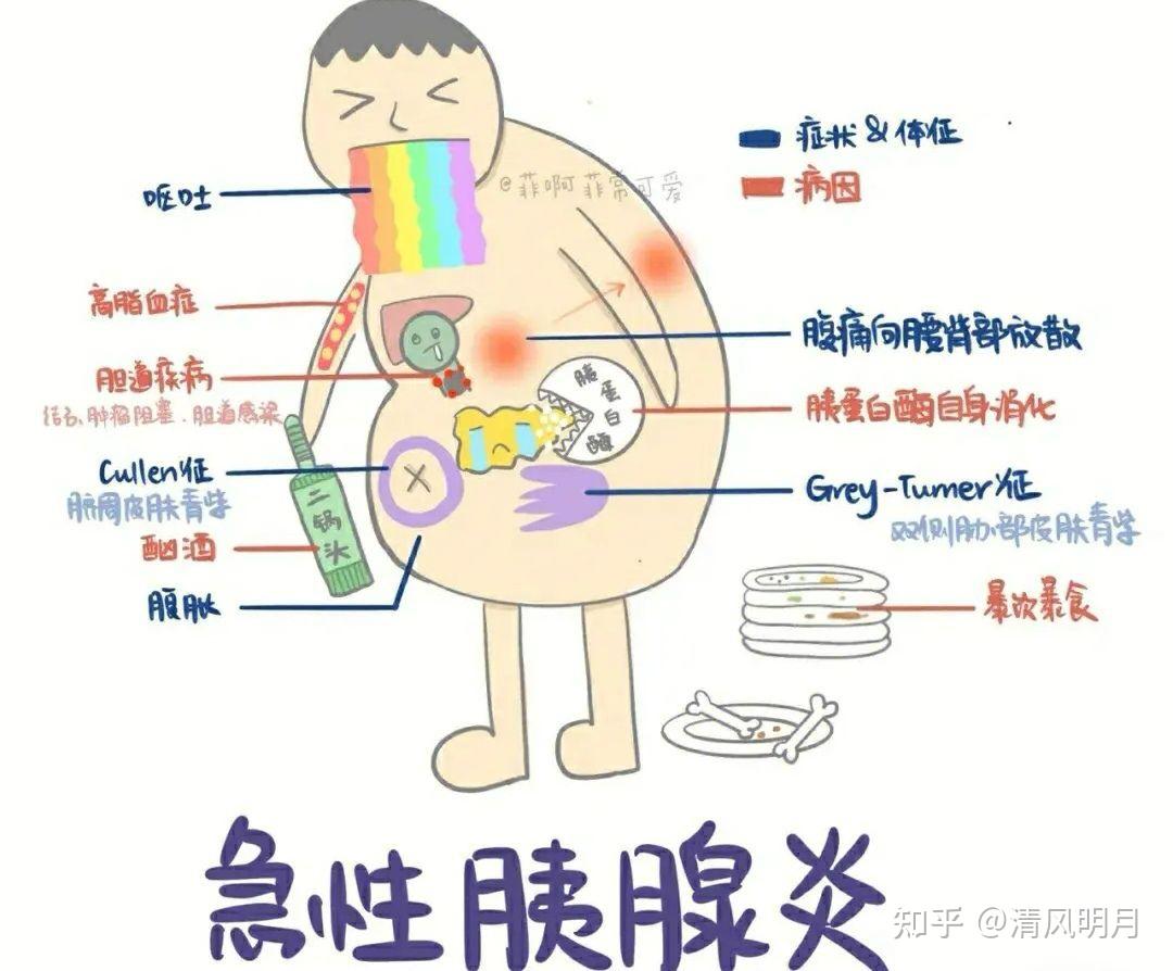 急性水肿型胰腺炎患者会出现什么症状?