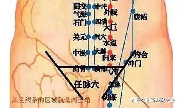 女性最下腹连三角区内剧痛,阴道口无恙,无分泌物,求问什么原因