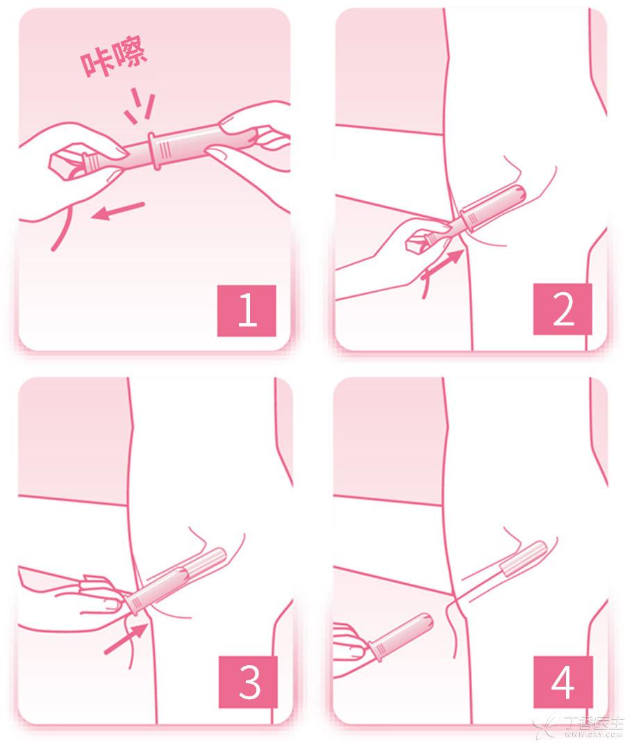 男友发现我用卫生棉条,就要和我分手,我该怎么办? - 知乎
