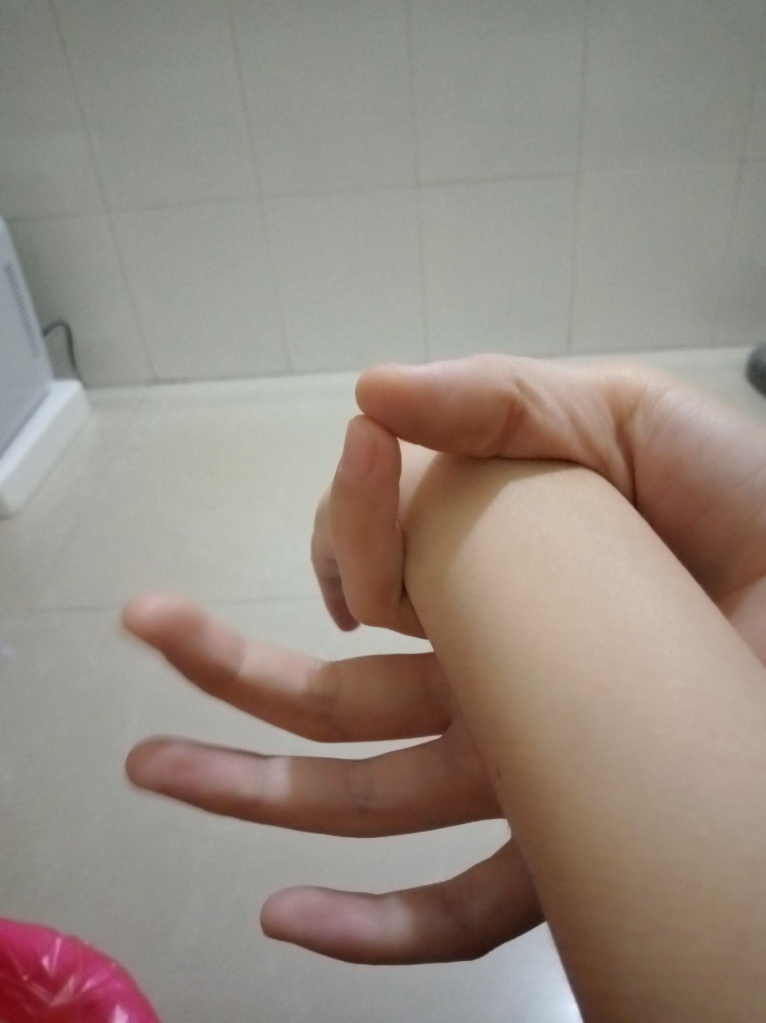 手臂太细是什么体验? - 知乎