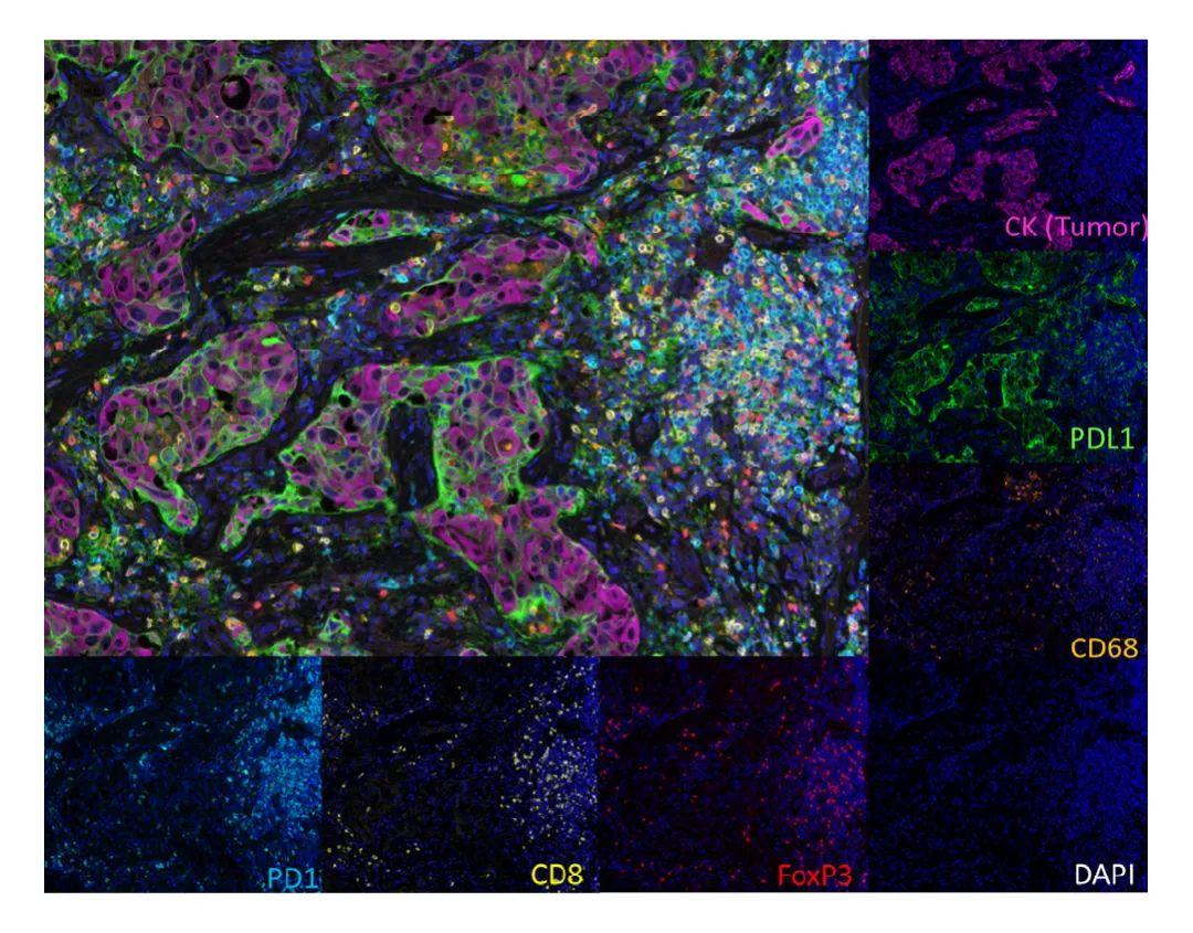 多重荧光免疫组化技术 (mIHC) 的原理什么，与 IHC 和 IF 有何区别？ - 知乎