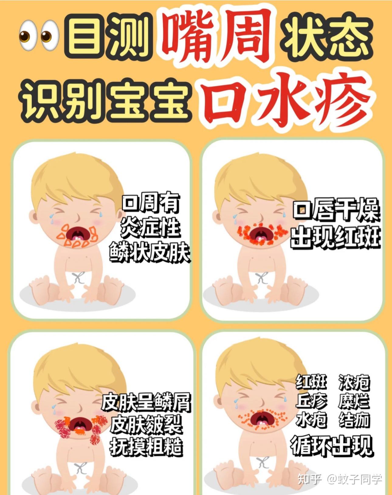 口周湿疹是由哪些因素引发的?