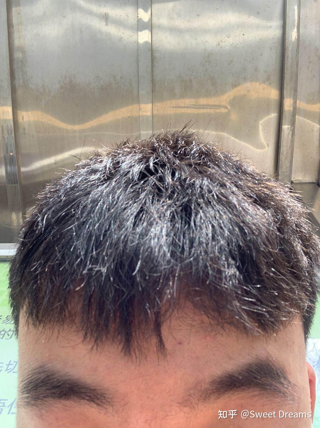 关注问题 67 写回答 登录/注册 男生形象 男生发型 头发剪得太丑是
