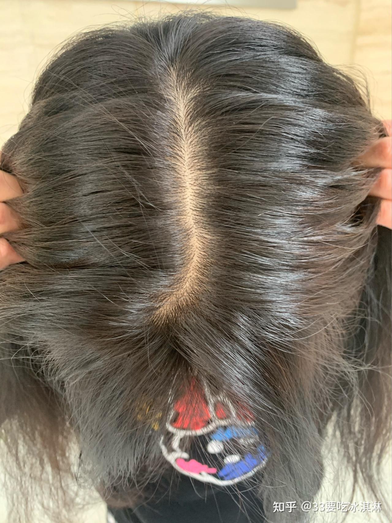 女生头发少怎样增加发量让头发多起来? - 知乎