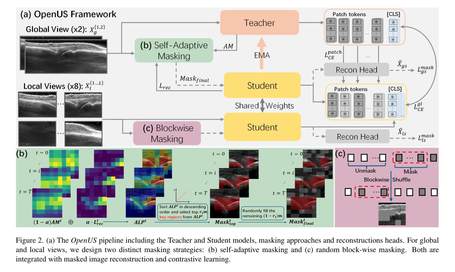 无监督/半监督/对比学习